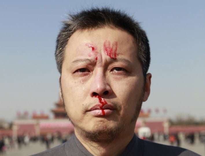 Hua Yong protests in Tiananmen Square, Beijing, with a bloody face after he punched himself in the nose.