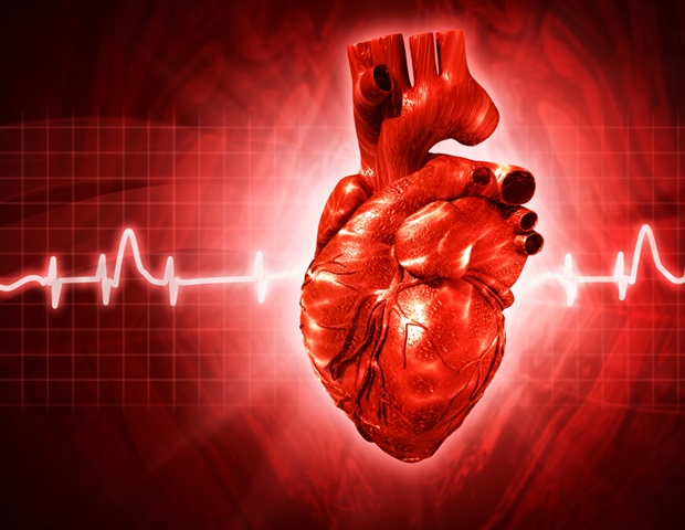Temporary Heart Support During Angioplasty Fails to Improve Outcomes, Raises Mortality Risk